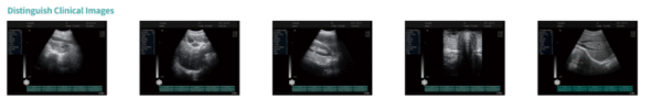 N20Full Digital Laptop Ultrasound Diagnostic System - Imagen 4