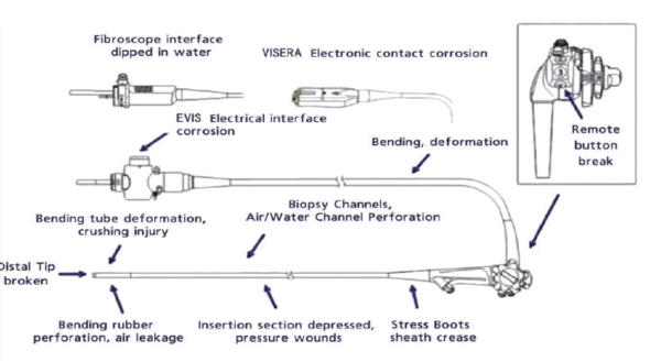 Flexible Endoscopy Repair - Image 5